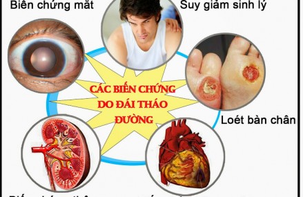 Ngộ nhận hay gặp về bệnh tiểu đường